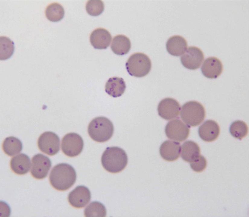 Hücrelerin içindeki ufak mor noktalar, Mycoplasma haemofelis türü bakteriler.