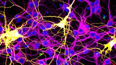 COVID-19 Kaynaklı Beyin Sisi Nöronların Kaynaşmasıyla Oluşuyor Olabilir!