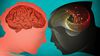 Nobel Ödülü Almak İsteyenlere Çağrı: Beyinle İlgili Çözülmeyi Bekleyen 10 Sır!