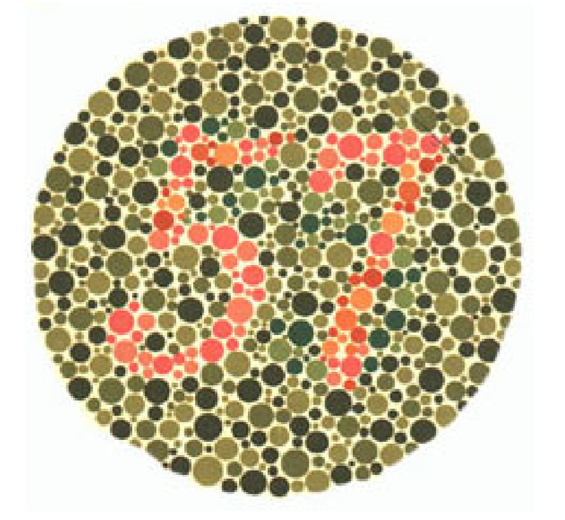 Plaka 5: Normal görüşlüler 57, kırmızı-yeşil renk körleri 35 sayısını görmeli.