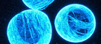 Laboratuvar Yapımı Yapay Hücrelerin İlk Adımları: Hareket Edebilen Sitoskeleton Hücre Zarı Üretildi!