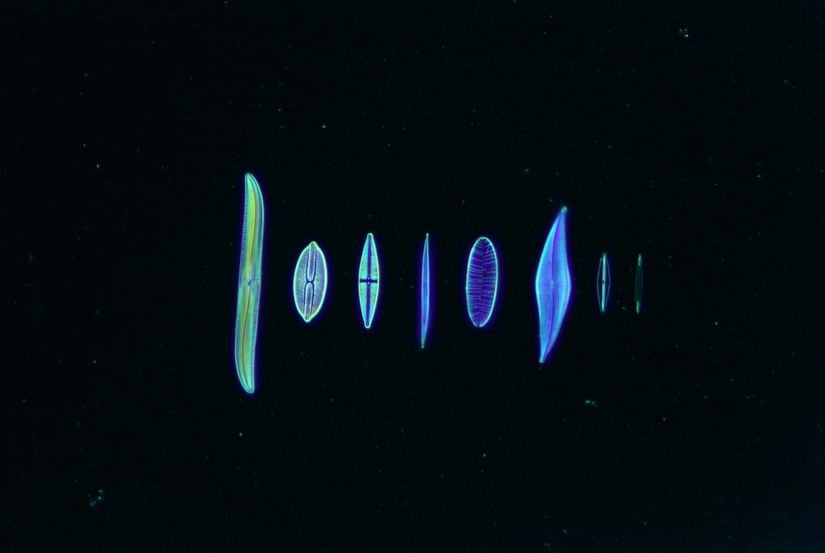 Diatomların karanlık alan mikroskobu görüntüleri (x100)