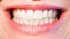 Dişlerimizde Evrimin İzleri: Diş Minesi ve ENAM Genlerinin Evrimi