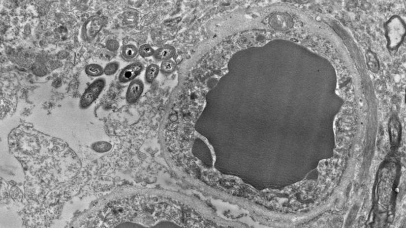 Elektron mikroskobu altındaki beyin kesitinde, kan damarının sol tarafında gözlemlenen bakteri topluluğu.