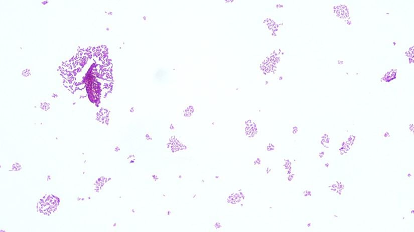 Işık mikroskobu altındaki görüntüsü, Salmonella enterica serovar Typhi.