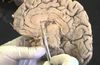 Sinirbilim ve Beyin - 13: Nasıl ''İnsan'' Olduk? Serebral Korteksin Alt Birimleri ve Görevleri...