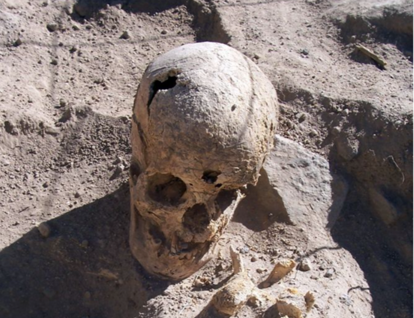 Peru'da bulunan genç bir kadına ait kafatası.
