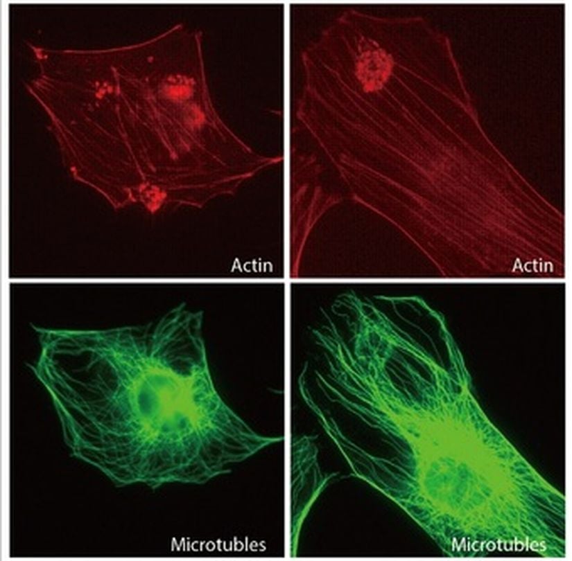 Proteinler bir hücrede yapısal bir role sahip olabilir. Aktin filamentleri (kırmızı) ve mikrotübüller (yeşil), hücrelere yapı sağlayan iki farklı protein türüdür.