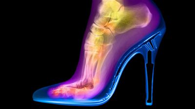 Topuklu Ayakkabılar Cinsel Seçilime Katkı Sağladı Mı?