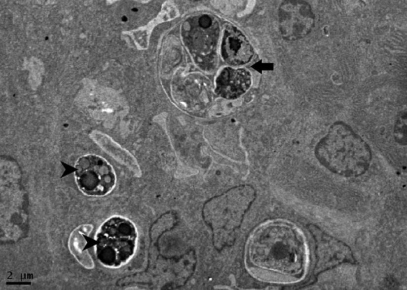 Bir önceki görseldeki köpeğe ait olan lenf nodlarından elde edilmiş örnekteki P. wickerhamii'nin Transmission Electron Microscope (TEM) görüntüsü.