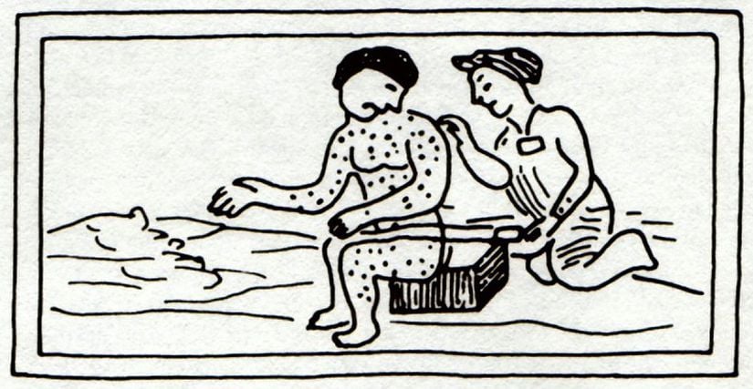 Kızamık hastası, Aztek çizimi