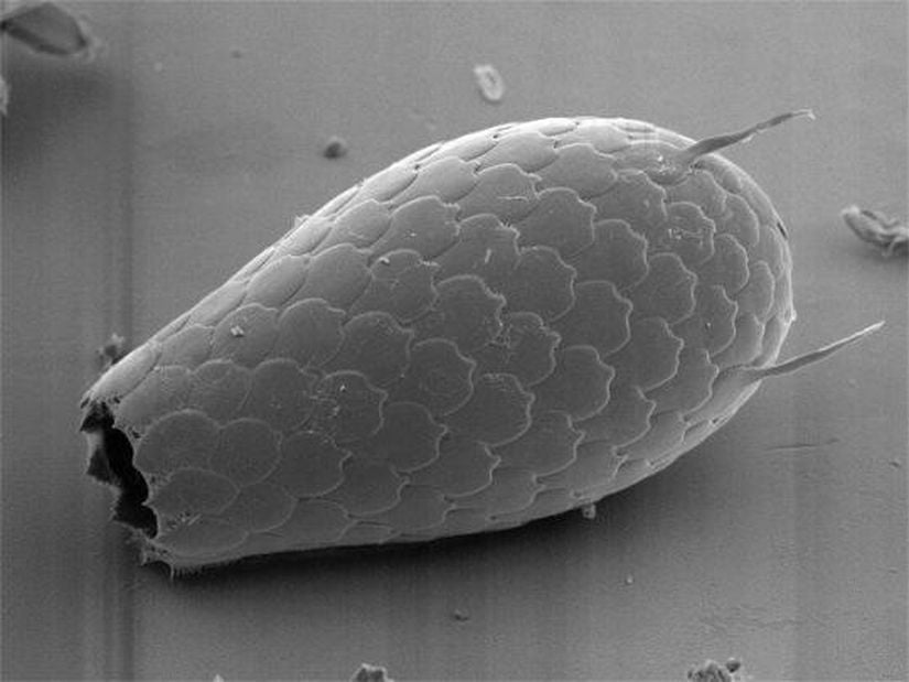 Euglypha (Cercazoa)