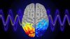 Epilepsi Nöbeti Sırasında Üretilen Beyin Dalgaları, Sese Dönüştürüldü!