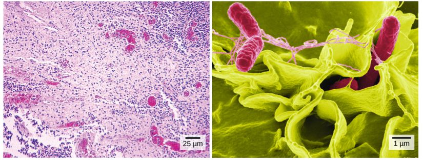 Soldaki görsel ışık mikroskobu ile gözlemlenmiş salmonella bakterisini göstermektedir. Sağdaki görsel ise taramalı elektron mikroskobuyla insan hücrelerini istila eden Salmonella bakterisini (kırmızı) göstermektedir.