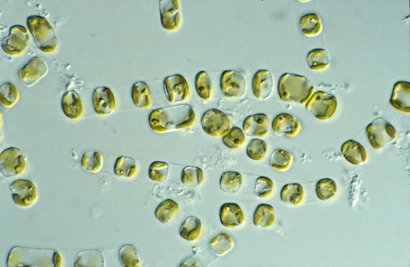 Mikroskop altında görülen diatomlar.