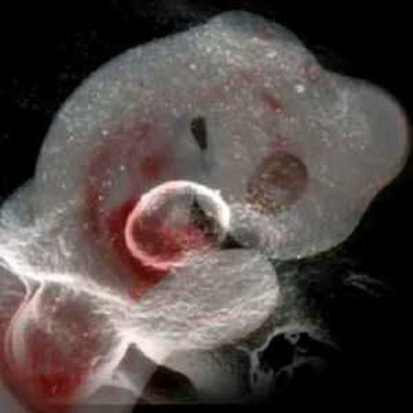 Yılan Embriyosunda Bacak Oluşumu