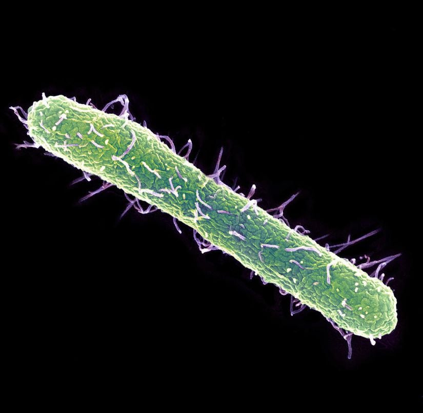 Salmonella typhimurium