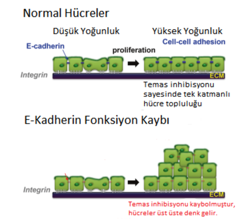E-Kadherin kaybı hücrelerin temas inhibisyonunu kaybetmesine ve üst üste çoğalmalarına sebep olur.
