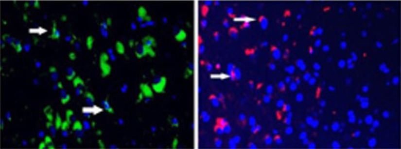 Nörodejeneratif bir hastalığı olan fareler, SDV1a aldıklarında hem terapötik kök hücreleri (kırmızı) hem de toksik hücreler (yeşil) kayboldu. Bu durum daha uzun ömür ve hastalık semptomlarının geciktirilmesine karşılık gelir. Bu sonuçlar, SDV1a'nın kök hücre tedavilerinin etkinliğini artırmak için kullanılabileceğini gösterdi.