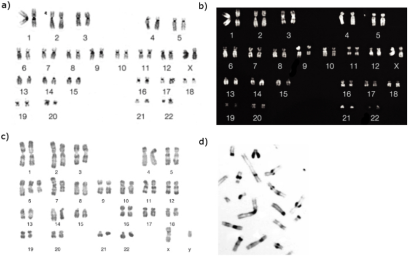 Farklı kromozomal boyama teknikleri, kromozom yapısıyla ilgili farklı varyasyonları ortaya çıkarır. Sitogenetikçiler bu örüntüleri inceleyerek, kromozomlar arasındaki farkları tespit edip, çeşitli fenotipik özelliklerle kromozomal anormallikleri ilişkilendirebilirler. Fotoğrafta, (a) Giemsa boyaması, (b) Q tipi bantlama, (c) R tipi bantlama ve (d) C tipi bantlama gözükmektedir.