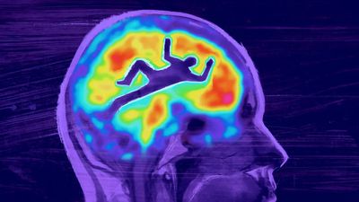Bilim İnsanları, Ölmekte Olan Bir Beyindeki Sinyalleri Kaydetmeyi Başardı!