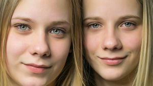 İkizler ve Gerçekler: İkizler Telepati ile İletişim Kurabilir, Birbirlerinin Acısını Hissedebilirler mi? İkizlerin Parmak İzi ve Genleri Aynı mı?