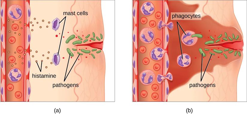 Mast hücreleri yakındaki hücrelerin zarar gördüğünü tespit eder ve histamin salgılayarak inflamatuar bir yanıt başlatır. Histamin yara bölgesine kan akışını artırır ve artan damar geçirgenliği sıvı, proteinler, fagositler ve diğer bağışıklık hücrelerinin enfekte dokuya girmesine izin verir. Bu olaylar yaralı bölgenin şişmesi ve kızarması ile sonuçlanır ve yaralı bölgeye artan kan akışı sıcaklık hissedilmesine neden olur. İnflamasyon, bu olayların dokudaki sinir ağrısı reseptörlerini uyarması nedeniyle ağrı ile de ilişkilidir. Fagosit PRR'lerinin hücresel tehlike sinyalleri ve patojenlerin yüzeyindeki PAMP'ler ve opsoninler ile etkileşimi, daha fazla proinflamatuar kimyasalın salınmasına yol açarak inflamatuar yanıtı artırır.