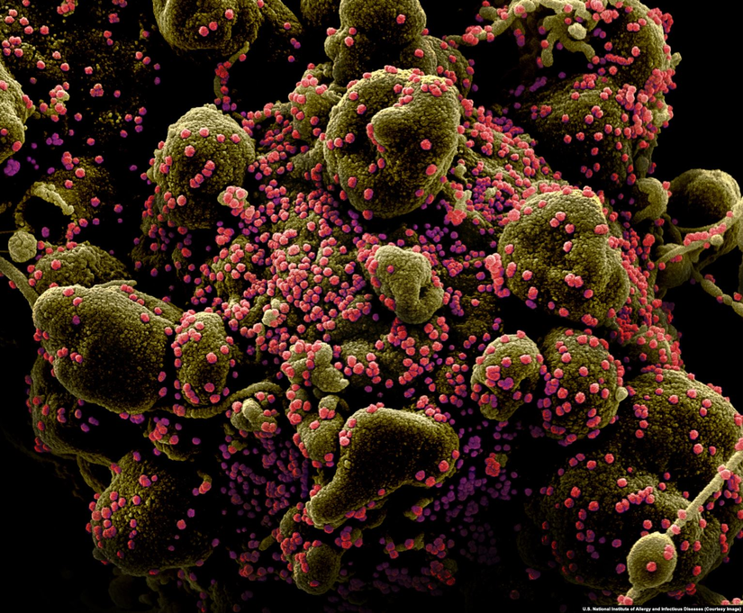SARS-CoV-2 istilasına uğramış insan hücresi