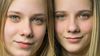 İkizler ve Gerçekler: İkizler Telepati ile İletişim Kurabilir, Birbirlerinin Acısını Hissedebilirler mi? İkizlerin Parmak İzi ve Genleri Aynı mı?