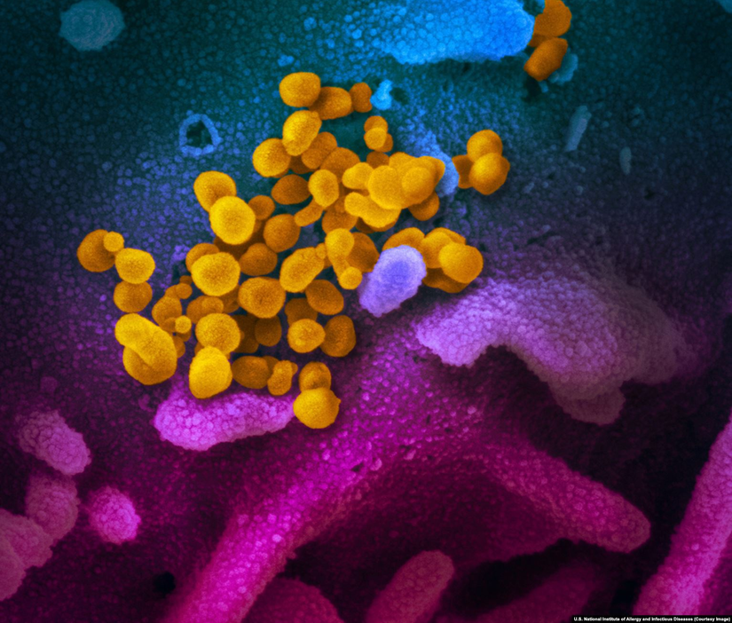 Hücreyi terk eden SARS-CoV-2 koronavirüsleri