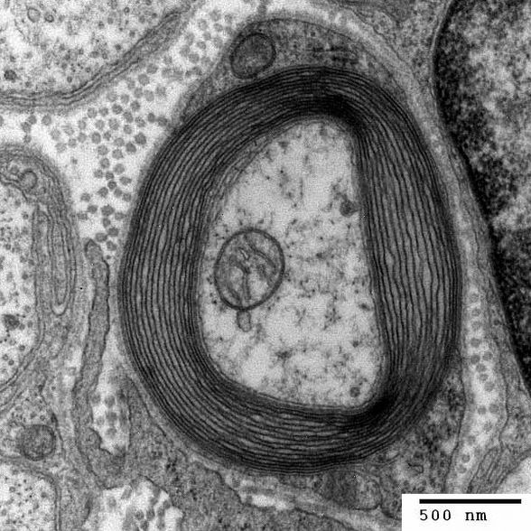 Görsel 1: Transmisyon elektron mikroskobunda myelin ile sarılmış bir aksonun görüntüsü.