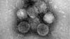 İnsan Koronavirüsü NL63 Enfeksiyonu Nedir? Diğer Koronavirüslere Göre Daha Ağır Hastalığa Neden Olur mu?