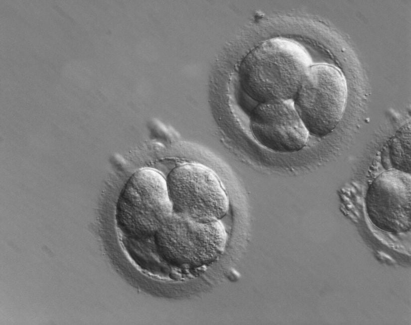Embriyoskopi sayesinde embriyo hücrelerinin nasıl bölündüğünü görebiliriz!