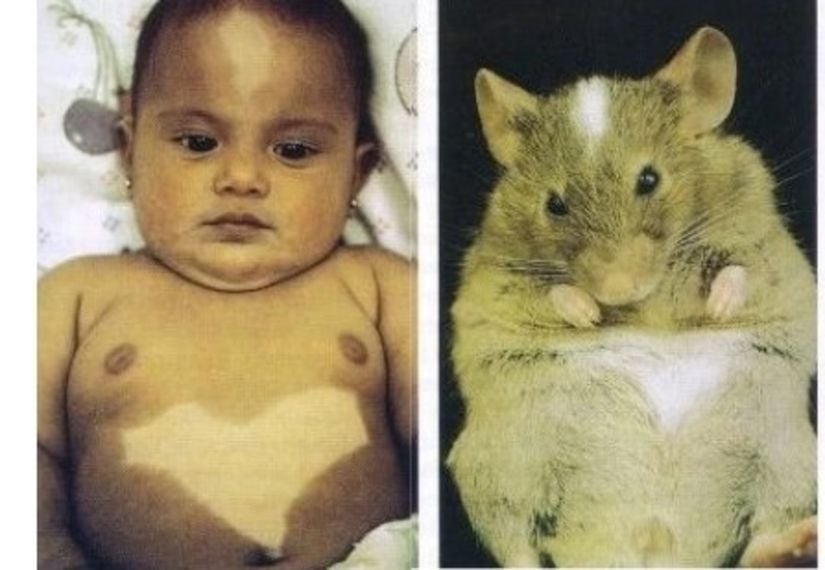 İnsanda ve farede Kit geni mutasyonu
