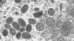 Mpox Virus Declared Global Health Emergency